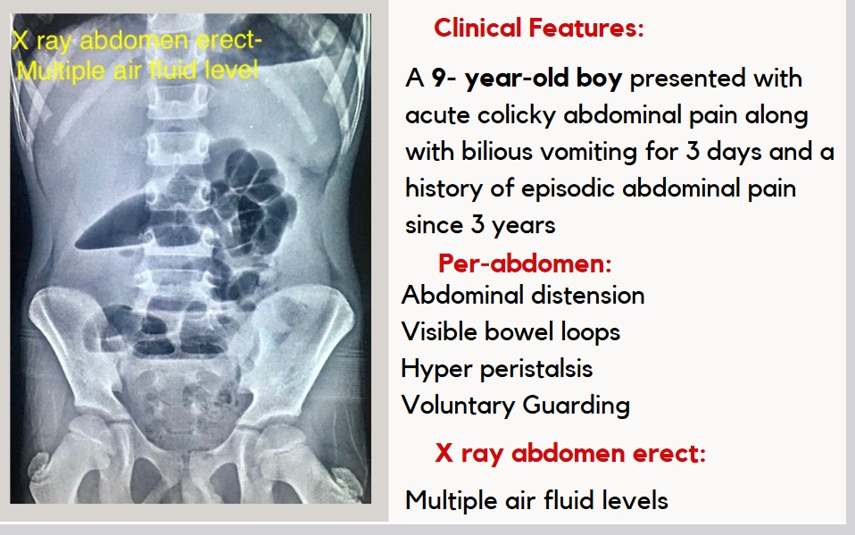 CDH1